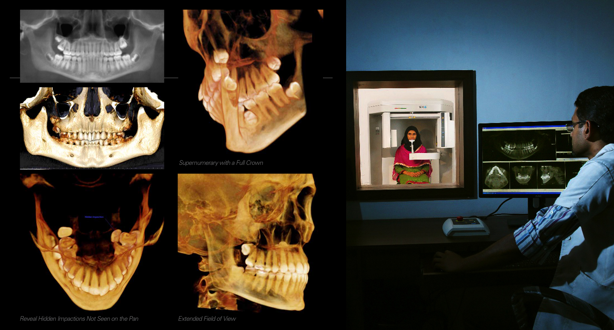 CBCT-CT-scan-in-calicut