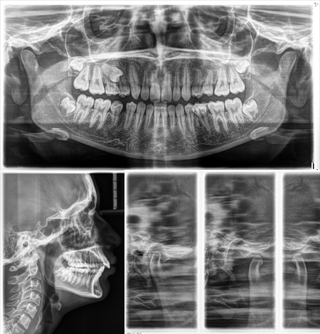 2D-Imaging in calicut