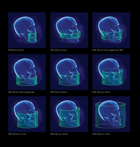 3D Imaging-Cone Beam CT(CBCT) in calicut